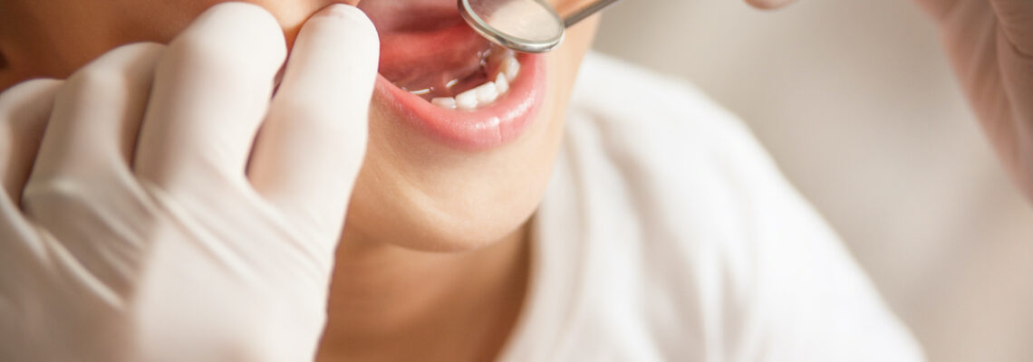 [VIDEO] Curare i denti da latte è importante?