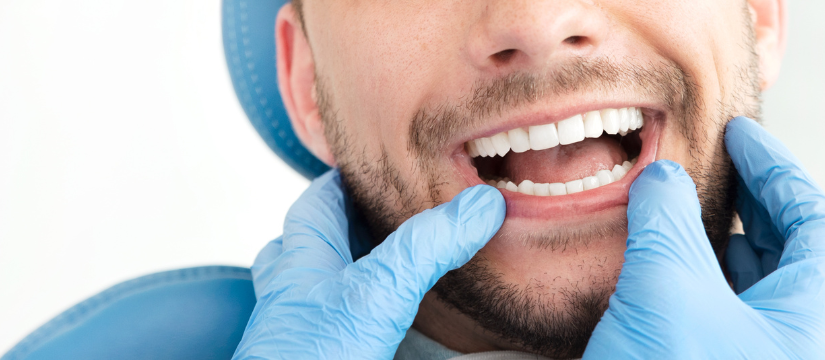 Dente scheggiato: recuperare la bellezza del proprio sorriso