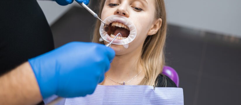 Macchie nere sui denti: cause e soluzioni