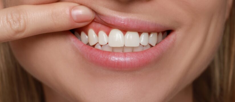 Flessibilità delle gengive: come mantenere una buona igiene orale per evitare infiammazioni