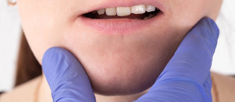 Malocclusioni: il trattamento ortodontico giusto per te a Chioggia